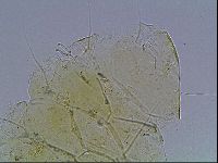 Echiniscus blumi image