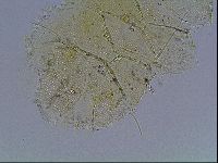 Echiniscus blumi image