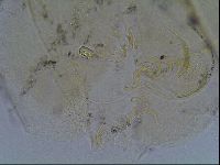 Echiniscus blumi image