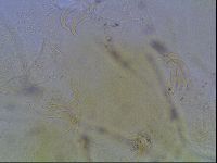 Echiniscus blumi image
