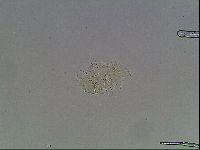 Echiniscus blumi image