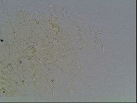 Echiniscus blumi image