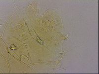 Echiniscus blumi image