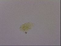 Echiniscus blumi image
