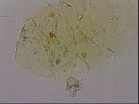 Echiniscus blumi image