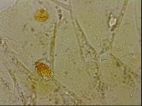 Echiniscus blumi image