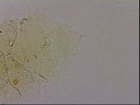 Echiniscus blumi image