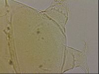 Echiniscus blumi image