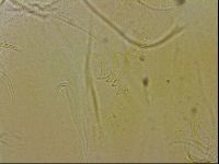 Echiniscus blumi image
