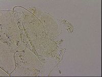 Echiniscus blumi image