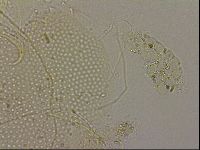 Echiniscus blumi image