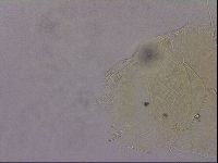 Echiniscus blumi image