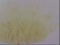 Echiniscus blumi image