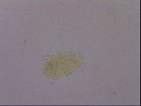 Echiniscus blumi image