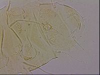 Echiniscus blumi image