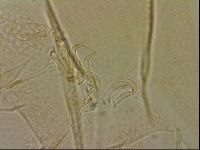 Echiniscus blumi image