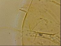 Echiniscus blumi image