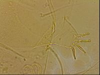 Echiniscus blumi image