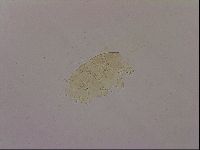 Echiniscus blumi image