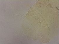 Echiniscus blumi image