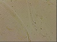 Echiniscus blumi image