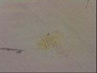 Echiniscus blumi image