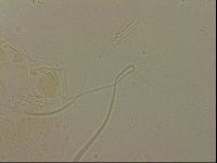 Echiniscus blumi image