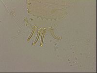 Echiniscus blumi image