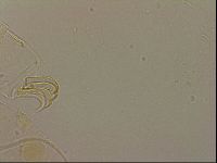 Echiniscus blumi image