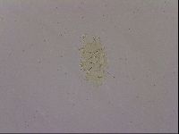 Echiniscus blumi image
