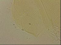 Echiniscus blumi image