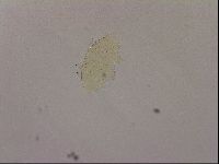 Echiniscus blumi image