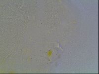 Echiniscus blumi image
