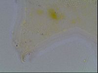 Echiniscus blumi image