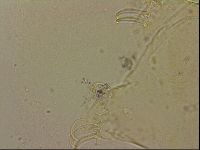 Echiniscus blumi image