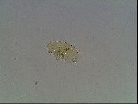 Echiniscus blumi image
