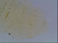 Echiniscus blumi image