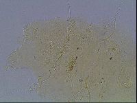 Echiniscus blumi image