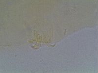 Echiniscus blumi image