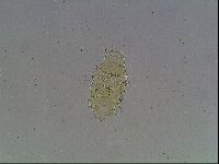 Echiniscus blumi image