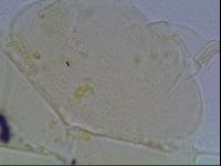 Echiniscus blumi image