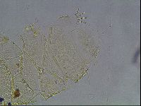 Echiniscus canadensis image