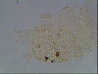 Echiniscus canadensis image