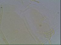 Echiniscus canadensis image