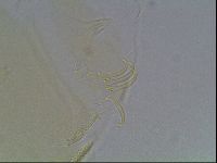 Echiniscus canadensis image