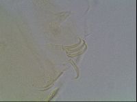 Echiniscus canadensis image