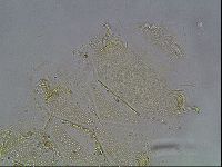 Echiniscus canadensis image