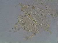 Echiniscus canadensis image