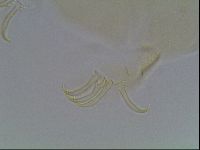 Echiniscus canadensis image