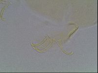 Echiniscus canadensis image